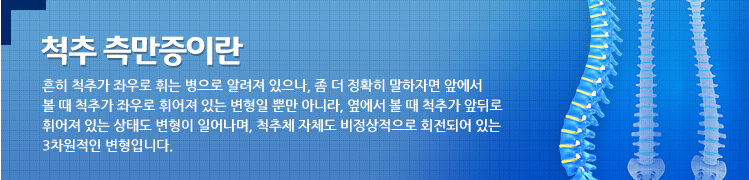 척추 측만증이란